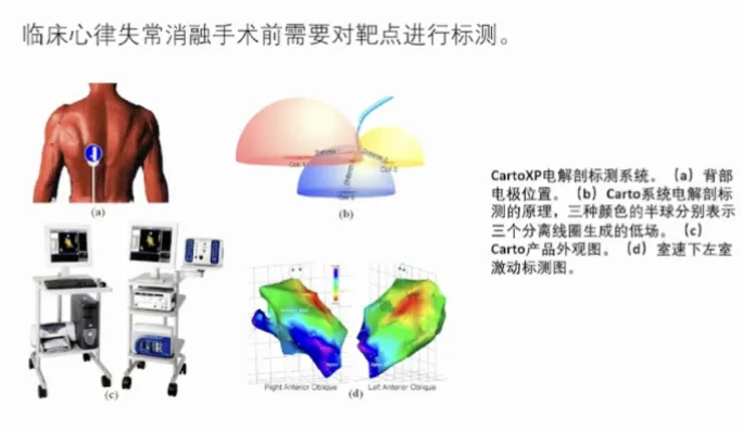 技术细腻又大心脏，如何摆脱定位球反击单一模式？